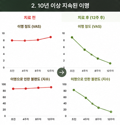 10년 이상 지속된 이명